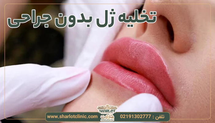 تخلیه ژل بدون جراحی