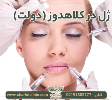 تزریق ژل در کلاهدوز