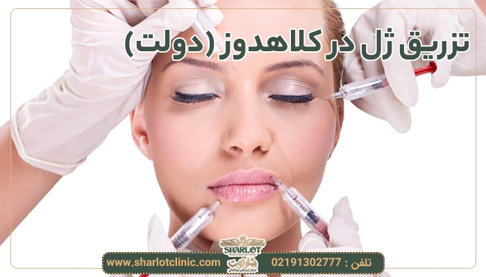 تزریق ژل در کلاهدوز