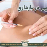 مزوتراپی در بارداری