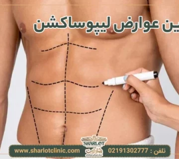 مهمترین عوارض لیپوساکشن