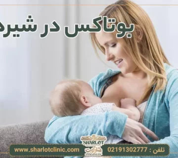 بوتاکس در شیردهی